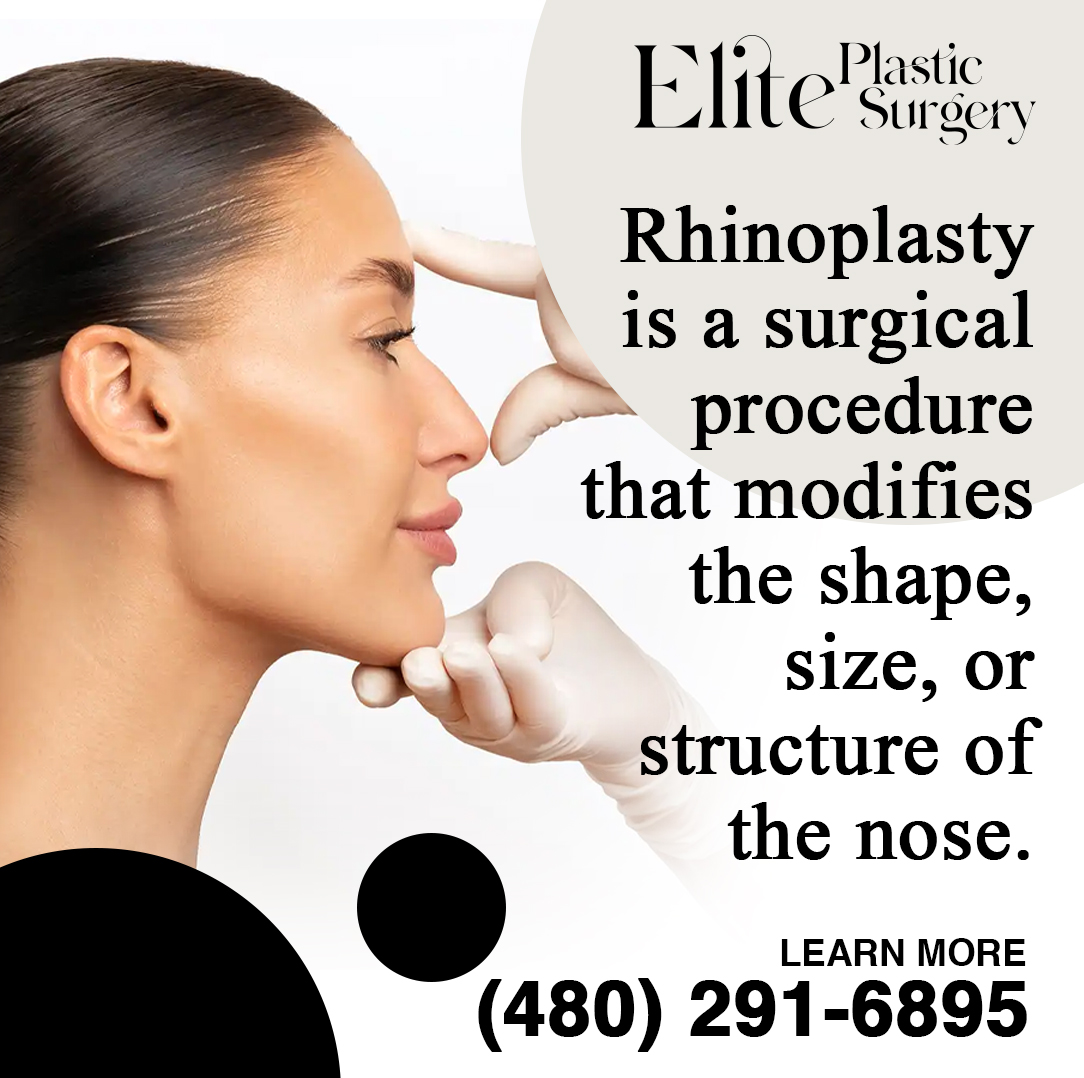 What is Rhinoplasty